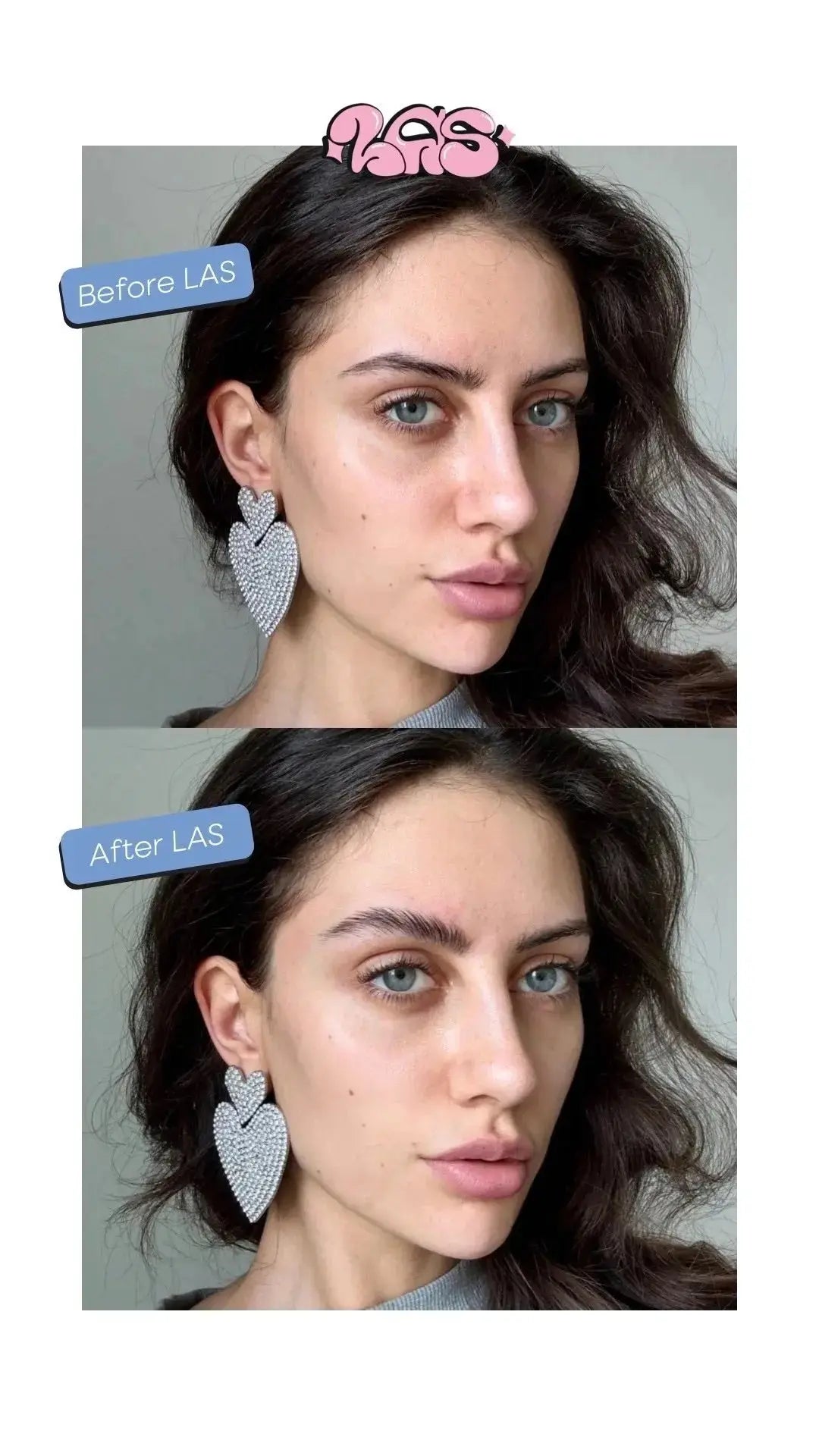 Summer Edition - LAS Natural Eyebrow Lifter My Store